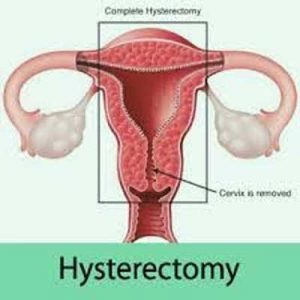 Even ovarian conservation does not alter increased risk of heart disease after hysterectomy