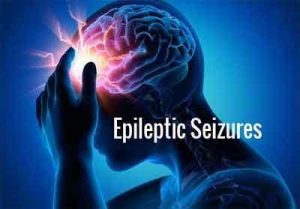 Epileptic seizures new analysis of brain network