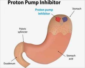Proton Pump inhibitors increase risk for hip fracture: Meta-analysis
