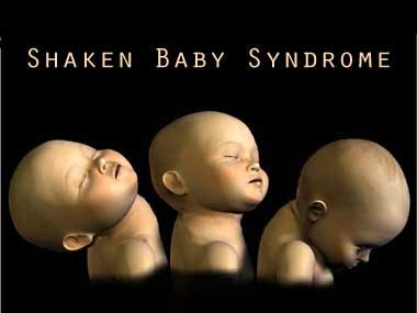 Soon, a blood test to detect shaken baby syndrome