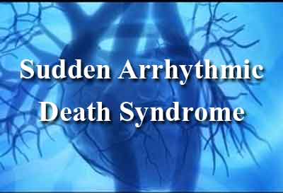 Post-Mortem Genetic Testing in Sudden Arrhythmic Death Syndrome