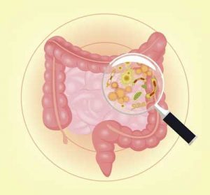 Diabetes linked to bacteria invading the colon
