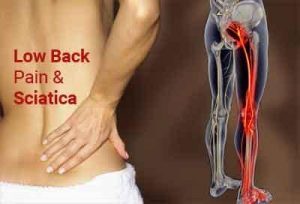 Low back pain and sciatica: Assessment and management, NICE guidelines