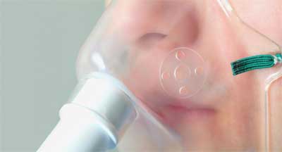 Bronchial thermoplasty helps reduce severe asthma attacks : Study