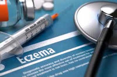 Severe eczema ups risk of Stroke,CVD