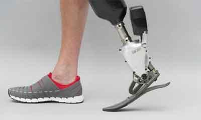 160-kg man walks on prosthetic limb