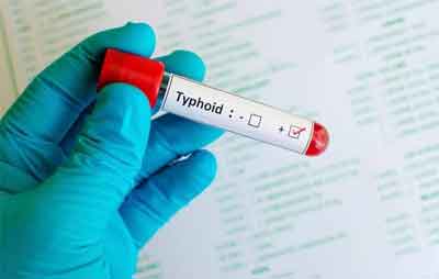 First typhoid conjugate vaccine Okayed by WHO