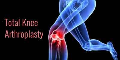 Study suggests new regime for pain management in total knee arthroplasty: Indian Journal of Orthopaedics