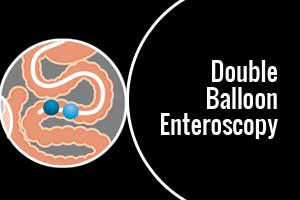 BGS Gleneagles Global Hospitals introduces Double Balloon Enteroscopy