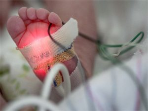 AAP releases Updated Guidance on Critical Care for Infants and Children