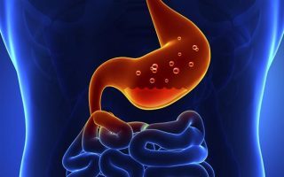 Long term PPI use may increase risk of gastric cancer