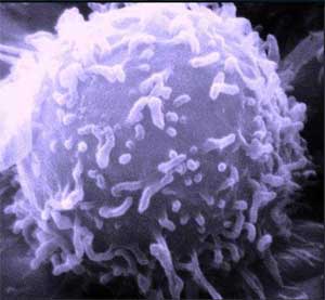 T-cells without  HDAC11 enzyme more effective in destroying cancer cells