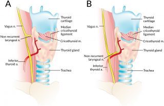 Researchers develop technique to monitor laryngeal and vagus nerves in surgery