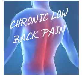 Evidence does not support the use of gabapentinoids for chronic low back pain