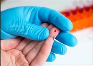 Finger prick test allows patients taking autoimmune drug to avoid blood draws