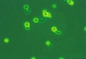 A step towards new drug for life-threatening Cryptococcus neoformans infections