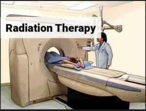 Study identifies new cancer treatments that might prevent relapses after radiotherapy