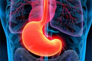 Haloperidol as adjunctive therapy superior to placebo for acute gastroparesis symptoms
