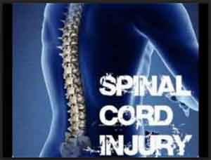 Epidural stimulation by electrical implant improves symptoms after spinal cord injury : JAMA