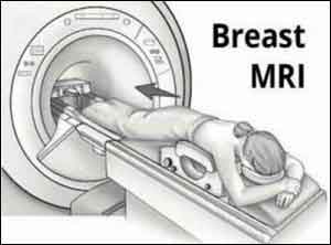 Bi-annual MRI better than annual mammography in high risk women