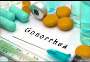 Gonorrhoea strains  becoming more susceptible to available treatment options