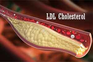 Lower the  LDL cholesterol level, lower is the risk to heart : JAMA