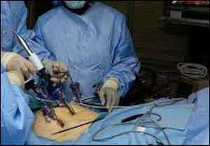 KGMU surgeons execute complicated cancer surgery by laparoscopic method