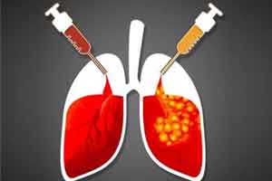 Vit A leads to autophagy, better clearance of the bacteria to control TB