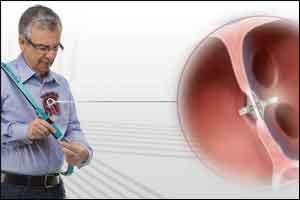 Miniature implant expected to bypass heart failure