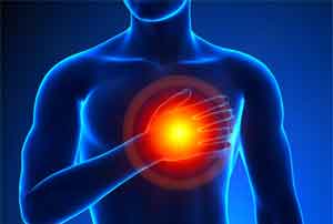 Heart attack risk linked to Fat distribution