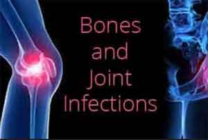 Oral antibiotics as good as intravenous in complex bone infections: NEJM