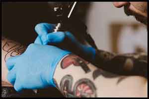 Delayed reaction to tattoo pigment may mimic lymphoma : Annals of Internal Medicine