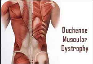 Risk Factors for Duchenne Muscular Dystrophy Identified