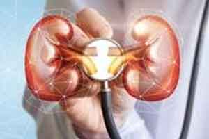 Vitamin B3 has potential to prevent Acute Kidney Injury