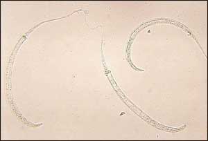Guinea worm disease eradication finally within reach