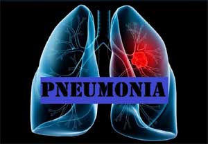 Bacterial Pneumonia causes worse heart complications than Viral Pneumonia