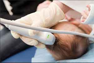 A tiny portable scanner for bedside brain imaging in neonates