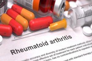 Antibiotics use linked to higher risk of rheumatoid arthritis