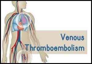 First Australasian guidelines for venous thromboembolism released