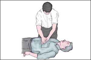 National Guidelines of Cardiopulmonary Resuscitation by Indian Society of Anaesthesiologists