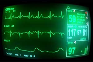 AHA updates practice standards for Inpatient ECG Monitoring