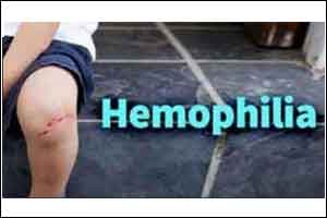 FDA clears dosing software for hemophilia A