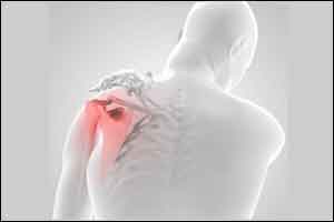 Steroid injection with in a month of rotator cuff surgery increases infection risk.