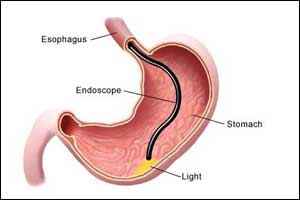 Oesophagogastrodudenoscopy(OGD) Guidelines by British Society of Gastroenterology & AUGIS