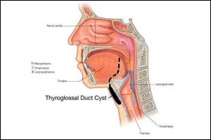 thyroglossal duct cyst anatomy