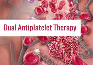 Six months dual antiplatelet therapy as effective as 12 months of DAPT in STEMI