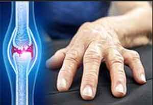 Centrally acting analgesics improve pain  in patients with hand osteoarthritis