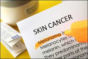 Researchers Develop First Blood Test for Melanoma