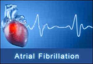 Annual screening of Atrial Fibrillation patients decreases Stroke risk