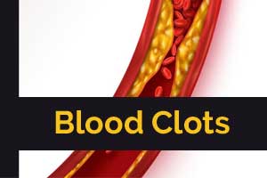 Clot-busting drugs not recommended for most patients with blood clots